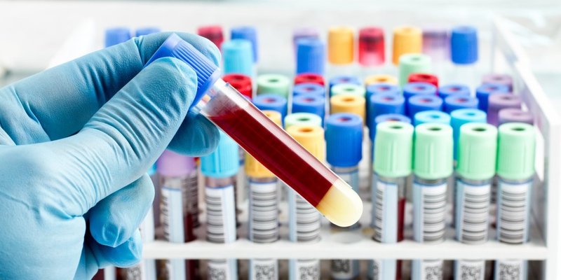 Europe Biomarker Technologies Market