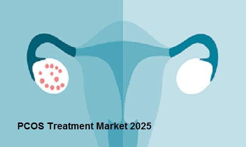 PCOS Treatment Market