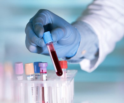 Global Clinical Diagnostics Market,