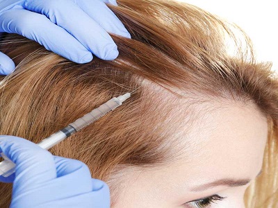 Alopecia Treatments Market