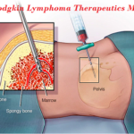 Global Non-Hodgkin Lymphoma Therapeutics Market