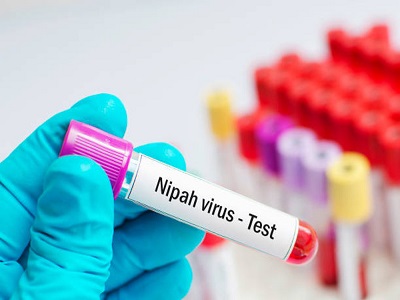 India NIPAH Virus Diagnostics Market - TechSci Research