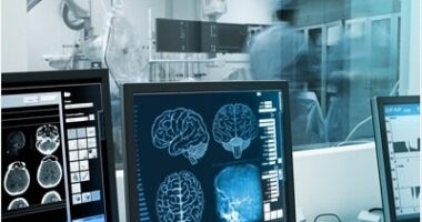 Japan Diagnostic Imaging Market - TechSci Research