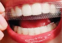Teeth Whitening Strips Market - TechSci Research