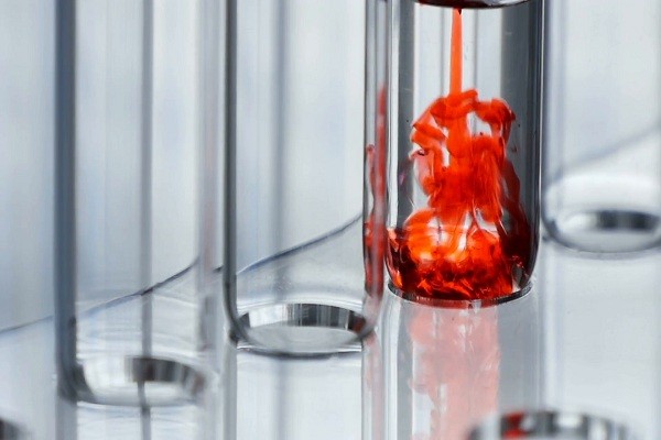 Global N-Butanol Market 2028 - Share, Trends & Forecast