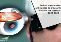 Retinal Implants Market